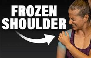 Frozen Shoulder: What It Is and How to Recover